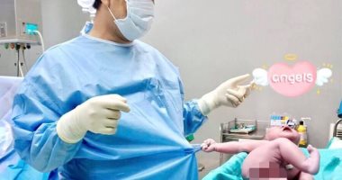 "رجعنى جوا تانى".. رضيع يمسك بملابس الطبيب عقب ولادته بلحظات