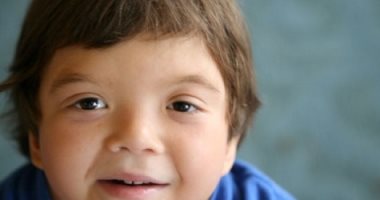 ما هى متلازمة نونان وكيف تتم الإصابة بها؟