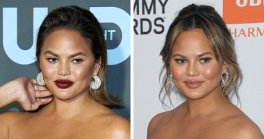 مش بيدارو.. 10 نجمات يعترفن بإجراء عمليات تجميل أبرزهن نيكول كيدمان
