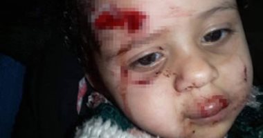 فيديو.. كلب يهاجم طفلة عمرها عام ونصف ويعقرها بشبرا مصر