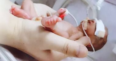 "أد كف الأيد".. طفل يولد قبل الأوان يزن 490 جراما فى الصين.. صور