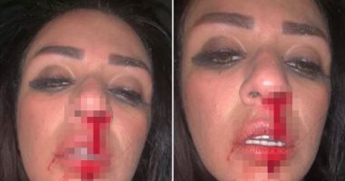 مطربة ستار أكاديمى: زوجى ضربنى أنا وأمى.. والجمهور: اعملى محضر