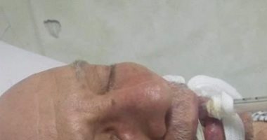 مناشدة لوزارة الصحة لتوفير رعاية مركزة لمريض بغيبوبة بمستشفى الصدر بإمبابة