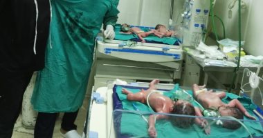 صور.. فريق النساء بمستشفى الأقصر الدولى ينقذ سيدة حامل فى 4 توائم بقيصرية مبكرة