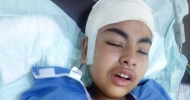 بعد سقوط الديسك على رأس تلميذ.. والده يطالب بالتحقيق فى الحادث