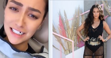 ألف سلامة.. شاى ميتشل تفقد أسنانها بسبب خبز البيجل.. فيديو