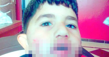 شكوى من انتشار الكلاب الضالة بمركز أدكو بالبحيرة وتعرض الأطفال للعقر