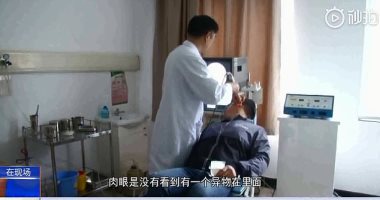 شعر بحكة فى أذنه.. صينى يذهب إلى الطبيب ليكتشف كارثة.. اعرف القصة؟