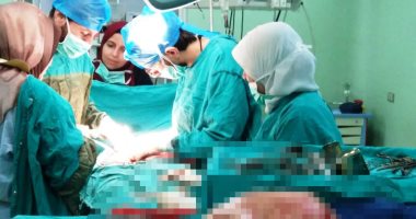 صور .. جراحه نادرة باستئصال ورم بالرحم وزنة 20 كيلو لمريضه ببنى سويف