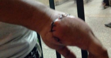استغاثة لعلاج حالة بعد احتجازها بالقصر العينى لمدة 14 شهرًا