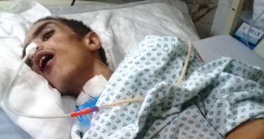 مأساة أم ممدوح.. تعول 5 أشقاء وصعقت الكهرباء كبيرهم.. وتناشد الدولة إنقاذ حياته