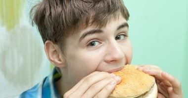 لو وزنك تقيل فى سن المراهقة فأنت أكثر عرضة للإصابة بهذا المرض عند البلوغ