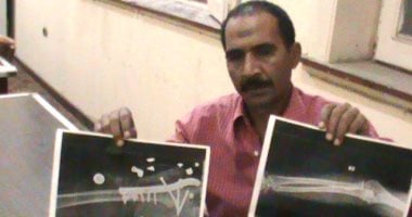 صور.. مأساة مواطن بالإسماعيلية فقد ساقه ولا يستطيع توفير نفقات أسرته