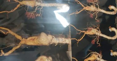 إنقاذ حياة مسن يعانى من تمدد الشريان الأورطى بمستشفى جامعة أسيوط