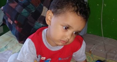 طفل عمره 4 سنوات يعانى من خلل جينى.. ووالده يناشد الصحة بعلاجه