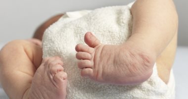 اعوجاج القدم عند الأطفال قد يعود لتدخين الأمهات.. اعرف السبب