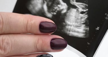 فوتوسيشن البيبى على الضوافر.. "صورة جنينك" آخر صيحات المانيكير