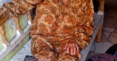 مسنة تطالب بمعاش تكافل وكرامة بعد إصابتها ببتر فى القدم