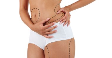 عشان الصيف بيكشف العيوب.. وصفات طبيعية لشد ترهلات الجسم