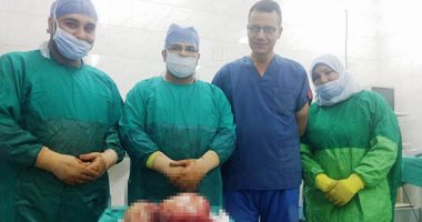 صور .. استئصال ورم يزن 11 كيلو  من رحم سيدة بمركز أورام طنطا