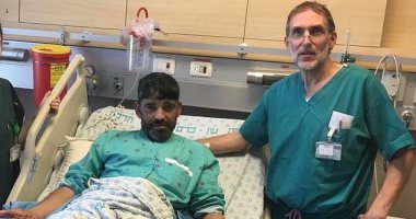 صور.. "الرجل الشجرة" يعيش حياة طبيعية بعد 4 عمليات جراحية