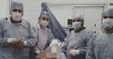 صور.. صحة الدقهلية: تغيير مفصل فخذ كامل لمواطن لأول مرة بمستشفى السنبلاوين