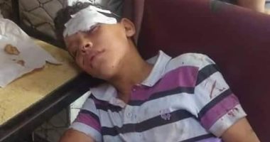 بيطرى القليوبية: حملة ضد الكلاب الضالة بشبرا الخيمة بعد هجومها على طفل