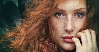 مفيش مشكلة ملهاش حل.. لو بتعانى من النمش إليك أبرز الحلول