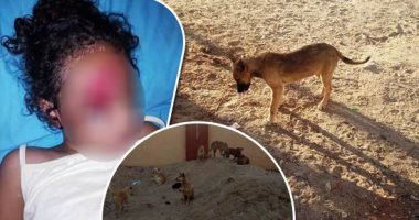 صور.. الكلاب الضالة تهدد حياة أهالى الإسماعيلية.. عقر 4 أطفال فى أبوسلطان.. والعناية الإلهية تنقذ طفلة من الموت.. الأهالى يطالبون بالقضاء عليها.. و"الطب البيطرى": قضينا على عدد كبير منها ومازال العمل جاريًا