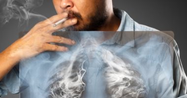 5 أشياء يجب معرفتها عن سرطان الرئة.. التدخين عامل الخطر الرئيسى