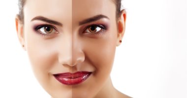 3 مواد طبيعية هتساعدك فى التخلص من اسمرار البشرة
