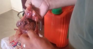 الطب الوقائى بالأقصر يعدم كميات لحوم غير صالحة للأستهلاك فى حملة بمطاعم الطود
