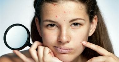 من غير مكياج يداريها.. وصفات طبيعية للتخلص من آثار الحبوب