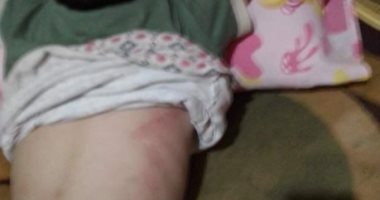 صور.. إصابة طفل إثر سقوط أجزاء من منزل مجهور عليه بالسنطة