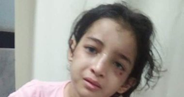 نقابة المحامين بدمياط تعلن تضامها مع طفلة تعرضت للتعذيب على يد زوجة والدها