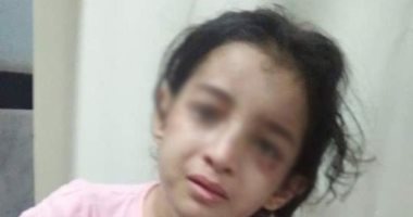 النيابة العامة تتحفظ على زوجة لتعذيبها ابنة زوجها بطريقة وحشية