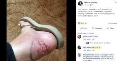 ومن الموضة ما قتل.. عارضة أزياء أمريكية تخاطر بحياتها من أجل أناقتها
