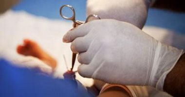 هل يحمى ختان الذكور من الإصابة بالإيدز؟.. دراسات تكشف مساهمته فى الوقاية بنسبة 60%..أمريكا تخالف أوروبا وتتجه لختان الغالبية العظمى من حديثى الولادة..الصحة العالمية تسعى لتطبيقه فى 14 دولة إفريقية لمواجهة المرض