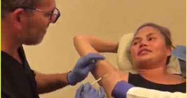 اعرف السبب الحقيقى وراء خضوع كريستى تيجن لحقن "البوتوكس" تحت الإبطين..صور