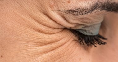 للتخلص من تجاعيد "رجل الغراب".. اعرفى طريقة عمل سيرم منزلى الصنع