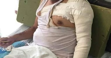 ضبط المتهمين بحرق محامى أبوكبير بالشرقية بعد تدخله لفض مشاجرة 