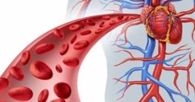 اكتشاف جزيئات عظم فى الدم تسبب تصلب الشرايين.. اعرف التفاصيل
