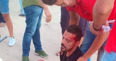 نقل عمرو زكى لمستشفى بالقاهرة لمتابعة حالته بعد حادث السيارة