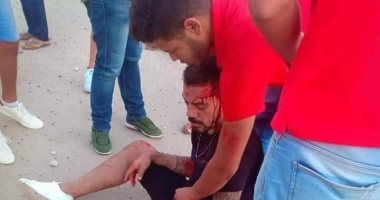 صحة مطروح: عمرو زكى يغادر مستشفى العلمين.. ونقله لمستشفى بالقاهرة