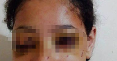 طالبة «مشاجرة الساحل» تروى تفاصيل ما حدث معها داخل المدرسة 