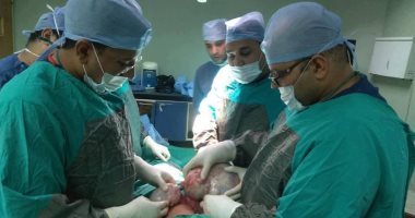 استئصال ورم يزن 7 كيلوجرامات من سيدة خمسينية بمستشفى قنا الجامعى