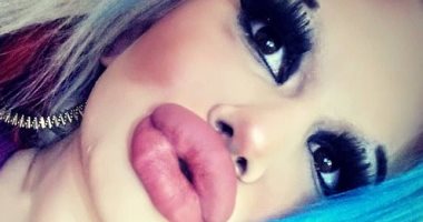 للحصول على لقب أكبر شفاه فى العالم.. بلغارية تنفق الآلاف على عمليات التجميل