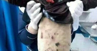 محامى أسرة الطفلة جنة ضحية التعذيب بالدقهلية: نطالب بأقصى عقوبة على المتهمة