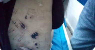 مفاجأة جديدة فى قضية وفاة الطفلة جنة ضحية تعذيب جدتها بالدقهلية.. محامى الضحية يكشف: شقيقتها "أمانى" تعرضت للتعذيب بنفس الطريقة بالكى والحرق فى أماكن حساسة.. النيابة تعاين جثة الضحية.. واستمرار حبس جدتها