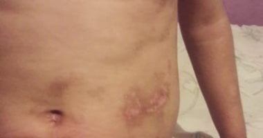 النيابة الكلية بالمنصورة تستدعى المتهمين بواقعة تعذيب أمانى شقيقة جنة 
